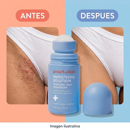 IMG-08-antes-despues-v3